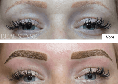 Portfolio - Beausense