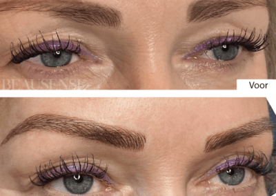 Portfolio - Beausense