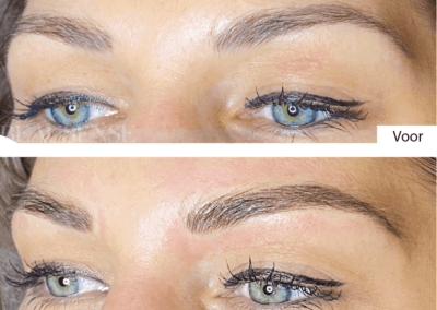 Portfolio - Beausense