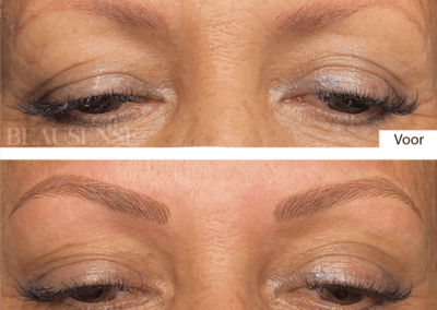 Portfolio - Beausense