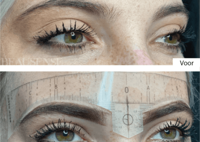 Portfolio - Beausense