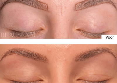 Portfolio - Beausense