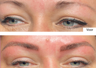 Portfolio - Beausense