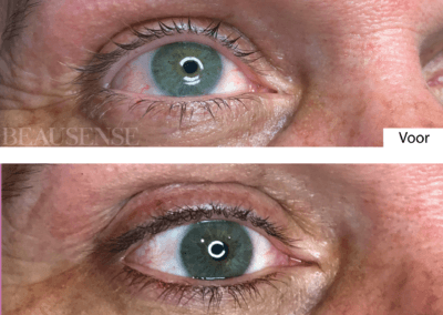 Portfolio - Beausense