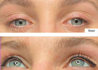 Portfolio - Beausense